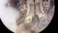 Restes osseux retrouvés dans une pelote de réjection - ici rat des moissons